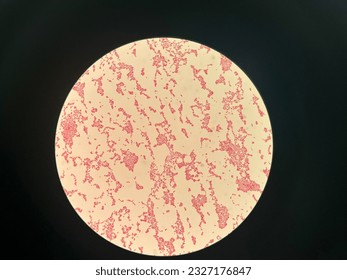 Bacterial staining Neisseria sicca under microscope in the Laboratory
