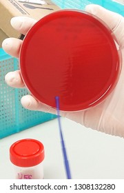 Bacterial Streaking On Blood Agar Plate Stock Photo 1308132280 ...