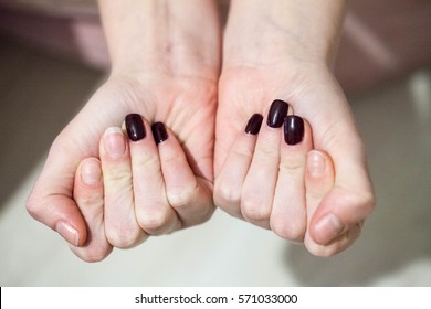 Bad Manicure Nails With Varnish And Without