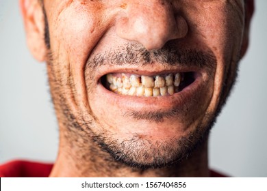 Bad men teeth with Top 20