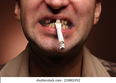 Bad Teeth Smoker