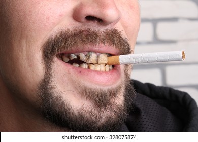 Bad Teeth Smoker Sick