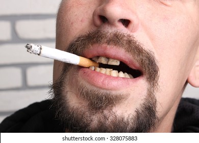 Bad Teeth Smoker Sick