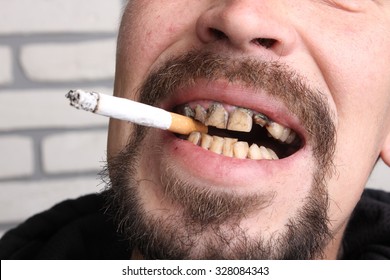 Bad Teeth Smoker Sick