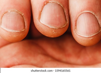 Cuticle Images, Stock Photos & Vectors | Shutterstock