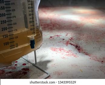 A Bag Full Of Clinical Waste And A Urine Bag On A Floor Covered With Dried Blood After A Major Operation In Which Heavy Bleeding Occurred.