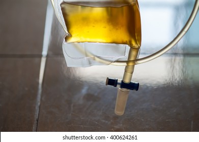 Bag urine of patients in hospitals.