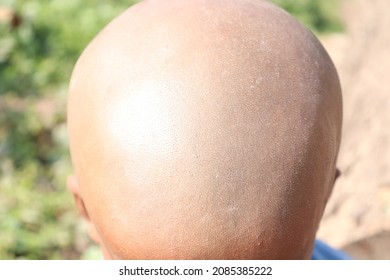 A Bald Closeup Of Child After Hire Cut