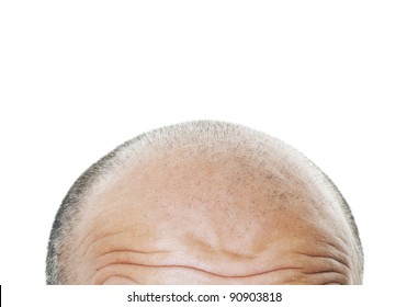 Bald Head