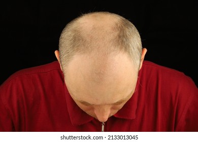 Bald head of a white European man