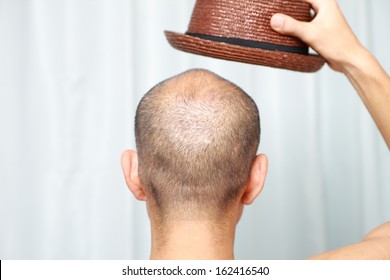 Bald Man With A Hat