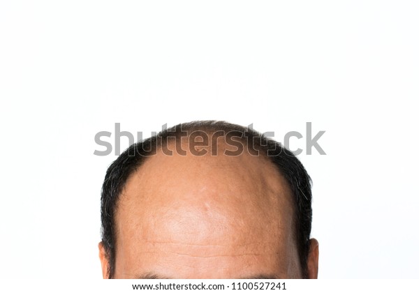 Bald Man Isolated On White Background Stock Photo Edit Now Shutterstock