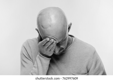Bald man psychological stress struggling for life arter brain tumor. Heartbreaking male emotions after cancer neurosurgery operation. Oncology survivor patient. Chemotherapy and irradiation head marks