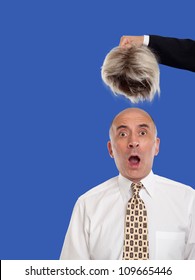 Bald Man Revealed By Removing The Toupee