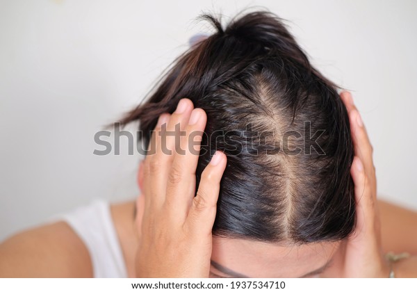 Bald man or woman worry about his or her less\
tthin hair on white\
background.