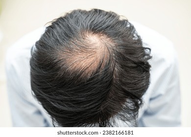 Bald in the middle head and begin no loss hair glabrous of mature Asian business smart active office man. - Powered by Shutterstock