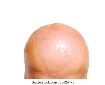 Bald senior head