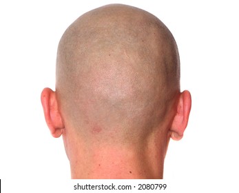 bald-headed guy