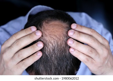 692 Brain bald male head Images, Stock Photos & Vectors | Shutterstock