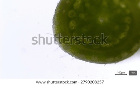 Bamboo Xylem and Phloem Under Microscope