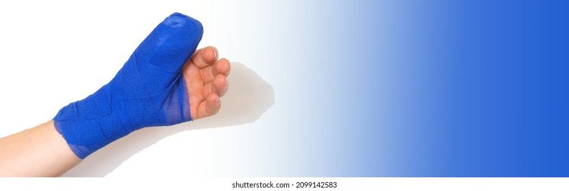 Bandaged Hand Isolated On White Background.Blue Surgical Bandage On The Arm.Fractures,sprains And Bandages.Surgical Dressing. Broken Arm.