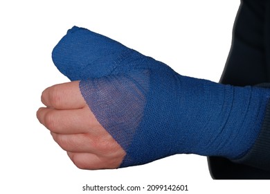 Bandaged Hand Isolated On White Background.surgical Bandage On The Arm.Fractures,sprains And Bandages.Medicine Concept. Surgical Dressing. Broken Arm.