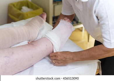 Lymphedema Management Wrapping Lymphedema Hand Arm Stock Photo ...