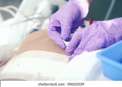 Bandaging patient's postoperative wound macro