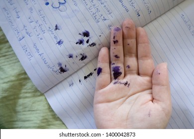 
Bangkok / Thailand - May 18 2018 : Broken Pen With Blue Ink Stain And Split Around Paper And Palm.