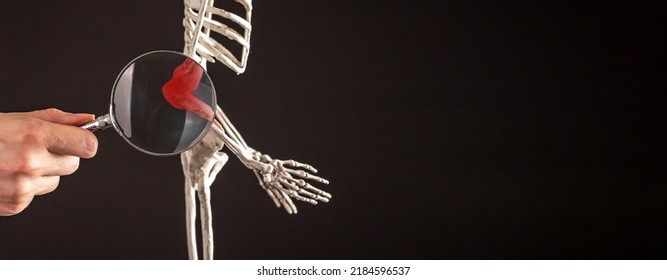 Banner with hand with magnifying glass over elbow bones of human skeleton with red point. Humerus, radius, ulna. Arm pain, anatomy study concept. Copy space. High quality photo - Shutterstock ID 2184596537