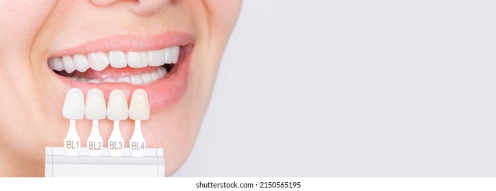 Banner tooth whitening, perfect white crown teeth close up with shade guide bleach color, female veneer smile, dental care and stomatology, dentistry, copyspace. - Shutterstock ID 2150565195