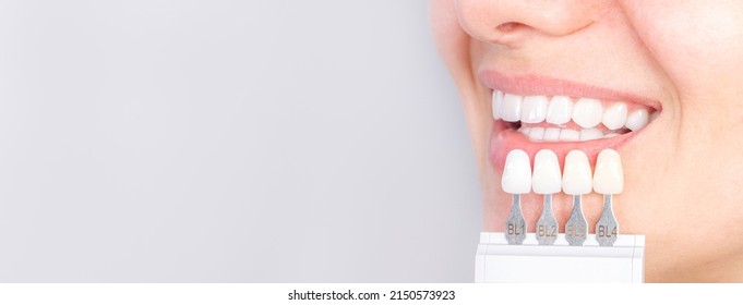 Banner tooth whitening, perfect white crown teeth close up with shade guide bleach color, female veneer smile, dental care and stomatology, dentistry, copyspace.
