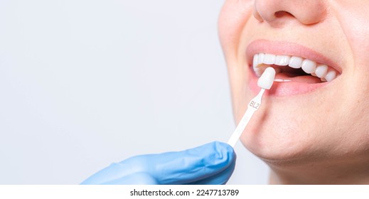 Banner tooth whitening, perfect white teeth close up with shade guide bleach color, female veneer smile, dental care and stomatology, dentistry, copyspace. - Powered by Shutterstock