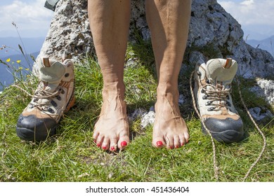 Bare feet and legs with Varicose Veins of tourist hiker, resting high in mountains