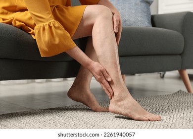 Barefoot woman with varicose veins on sofa in room, closeup