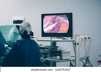 Bariatric weight loss surgery with a gastric band or through removal of a portion of the stomach or gastric bypass surgery with endoscopy and laparoscopic gastric sleeve surgery