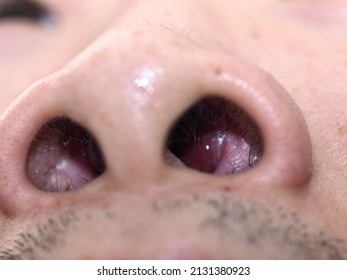 The Base View Of The Nose In Macro Photography Showing Nasal Passage And Nasal Hair