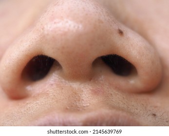 The Base View Of The Nose In Macro Photography Showing Nasal Passage And Nasal Hair