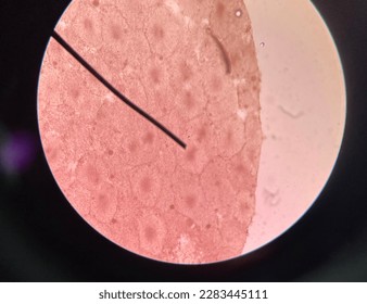 Basic phase of mitosis (Anaphase)