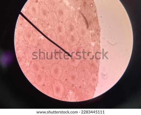 Basic phase of mitosis (Anaphase)