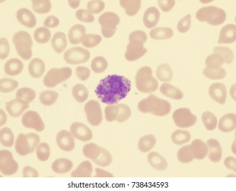 Basophil