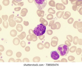 Basophil