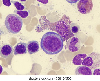 Early myelocyte Images, Stock Photos & Vectors | Shutterstock