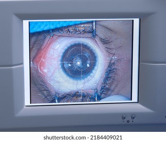 Basra, Iraq - July 16, 2022: Photo Of Femto Second Lasik Machine