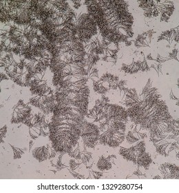 Batrachospermum sp. algae under microscopic view