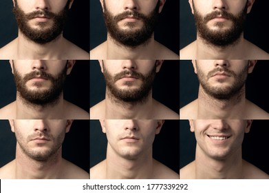 Beard, Shave Before And After. Male Chin Close-up With A Beard, Bristles And Smooth-billed. Collage Of Varying Degrees Of Hair Growth.