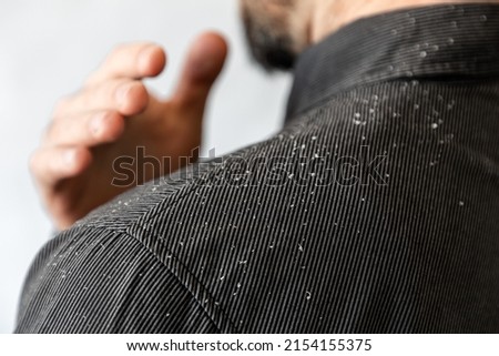 A bearded man in a black shirt shakes dandruff of his shoulder. Close-up. The concept of psoriasis and seborrheic dermatitis. Foto stock © 