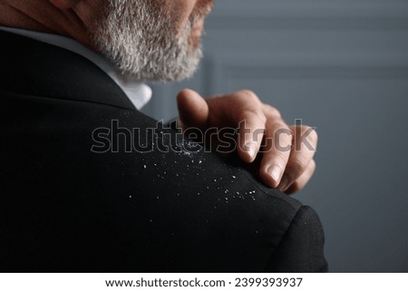 Bearded man brushing dandruff off his jacket on grey background, closeup