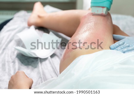 Beautician Accomplishing Depilation With Hot Wax On Woman`s Leg Using Wax Device In Spa. horizontal Image Composition