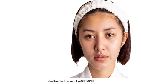 Beautiful Asian Woman Gets Freckles, And Dull Skin On Her Face. Pretty Young Woman Get Problems Of Facial Skin. She Looks Unhappy. Isolated On White, Copy Space. Asia Lady Get Bare Face No Makeup  